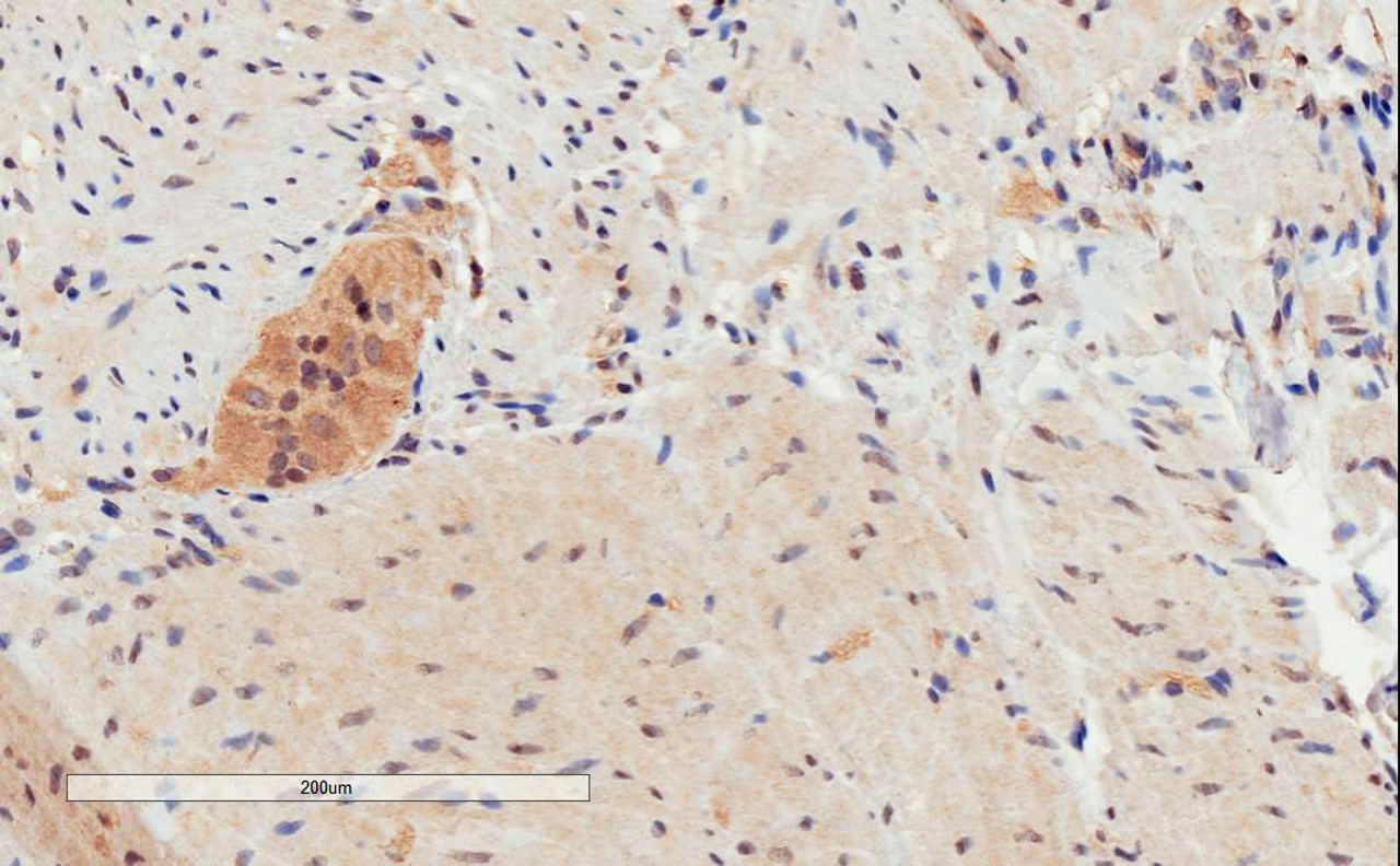 46-730 (3.75ug/ml) staining of paraffin embedded Human Skin. Steamed antigen retrieval with citrate buffer pH 6, AP-staining.