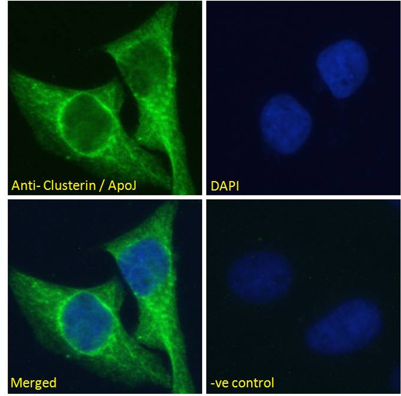 46-749 (0.1ug/ml) staining of Rat Brain lysate (35ug protein in RIPA buffer) . Primary incubation was 1 hour. Detected by chemiluminescence.