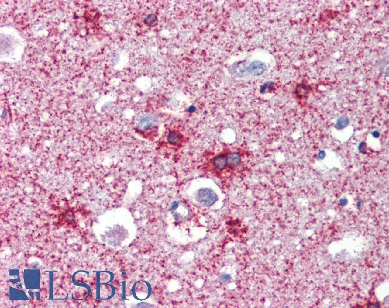 46-756 (2.5ug/ml) staining of paraffin embedded Human Breast. Steamed antigen retrieval with citrate buffer pH 6, AP-staining.
