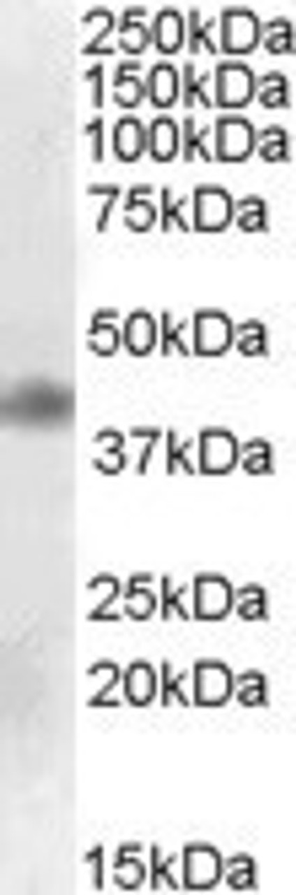 46-761 (1ug/ml) staining of Mouse Spleen lysate (35ug protein in RIPA buffer) . Primary incubation was 1 hour. Detected by chemiluminescence.