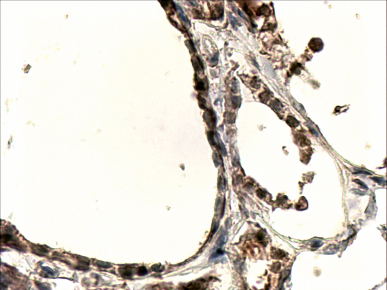 46-853 (1ug/ml) staining of Human Liver lysate (35ug protein in RIPA buffer) with (B) and without (A) blocking with the immunising peptide. Primary incubation was 1 hour. Detected by chemiluminescence.