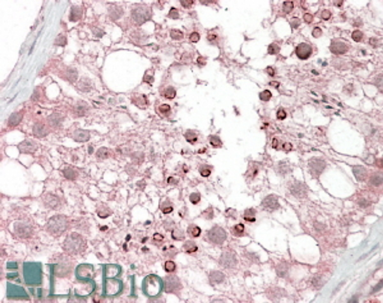 46-858 (5ug/ml) staining of paraffin embedded Human Placenta. Steamed antigen retrieval with citrate buffer pH 6, AP-staining.