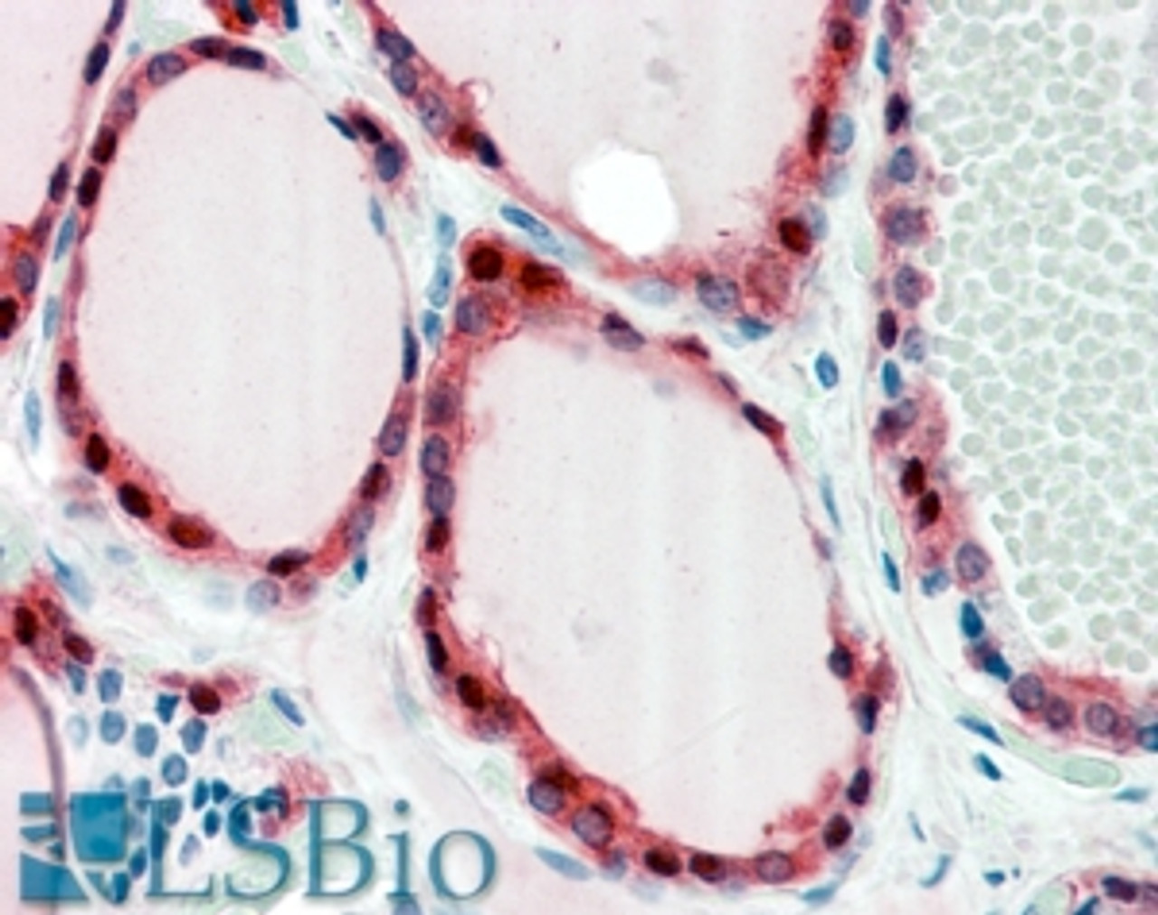 46-868 (3.75ug/ml) staining of paraffin embedded Human Breast. Steamed antigen retrieval with citrate buffer pH 6, AP-staining.