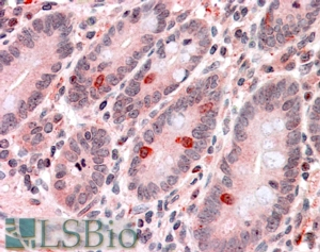 46-908 (0.1ug/ml) staining of Human Pancreas Lysate (35ug protein in RIPA buffer) . Primary incubation was 1 hour. Detected by chemiluminescence.