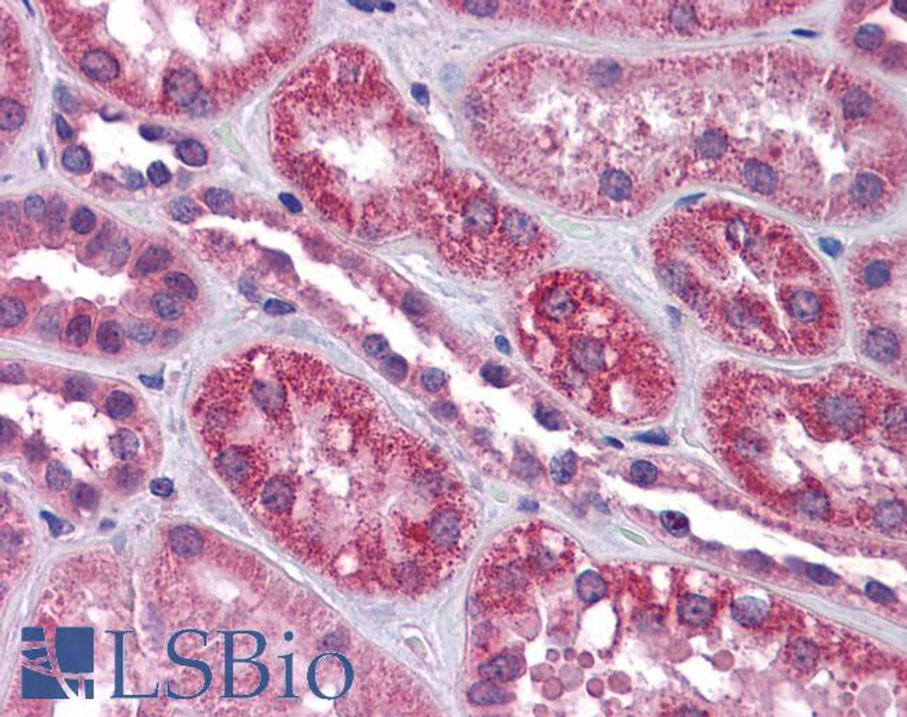 46-913 (0.3ug/ml) staining of Rat Brain lysate (35ug protein in RIPA buffer) . Detected by chemiluminescence.