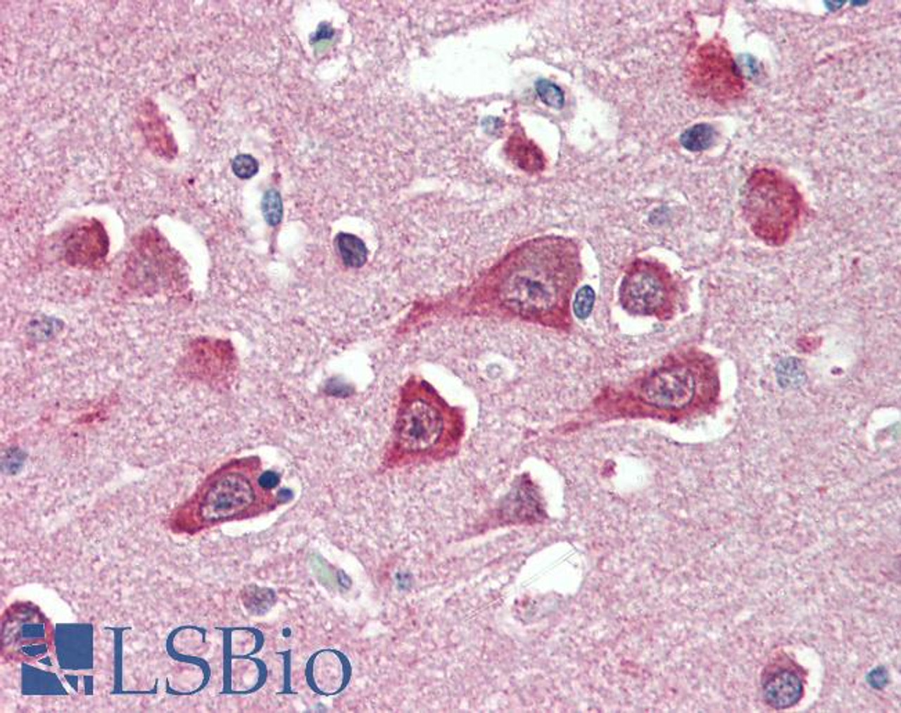 46-913 (4.75ug/ml) staining of paraffin embedded Human Placenta. Steamed antigen retrieval with citrate buffer pH 6, AP-staining.