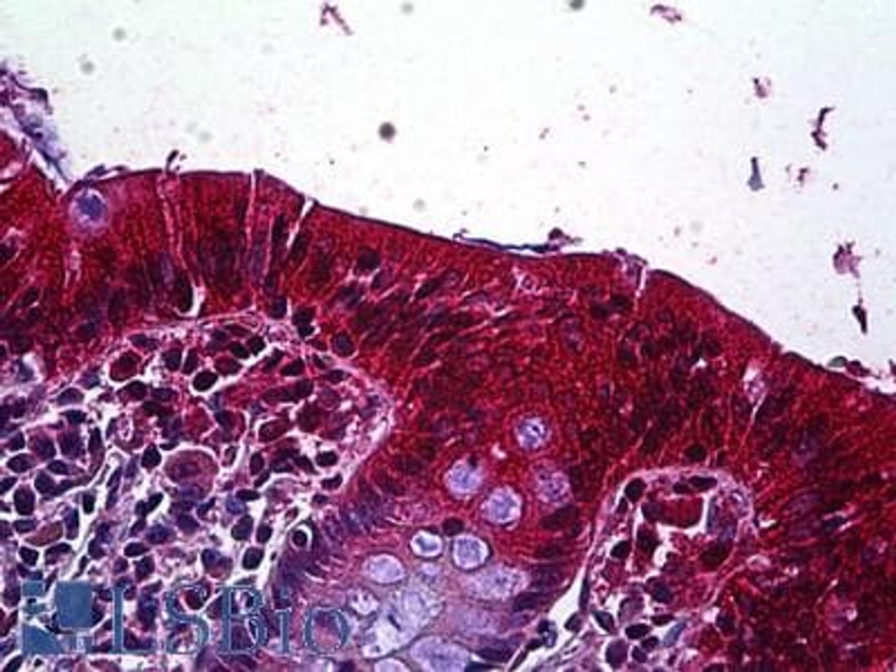 46-950 Negative Control showing staining of paraffin embedded Human Colon, with no primary antibody.