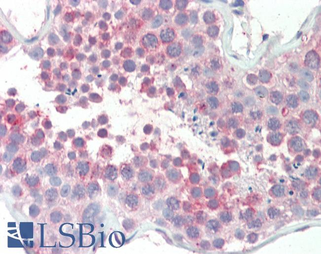 46-955 (3.8ug/ml) staining of paraffin embedded Human Kidney. Steamed antigen retrieval with citrate buffer pH 6, AP-staining.