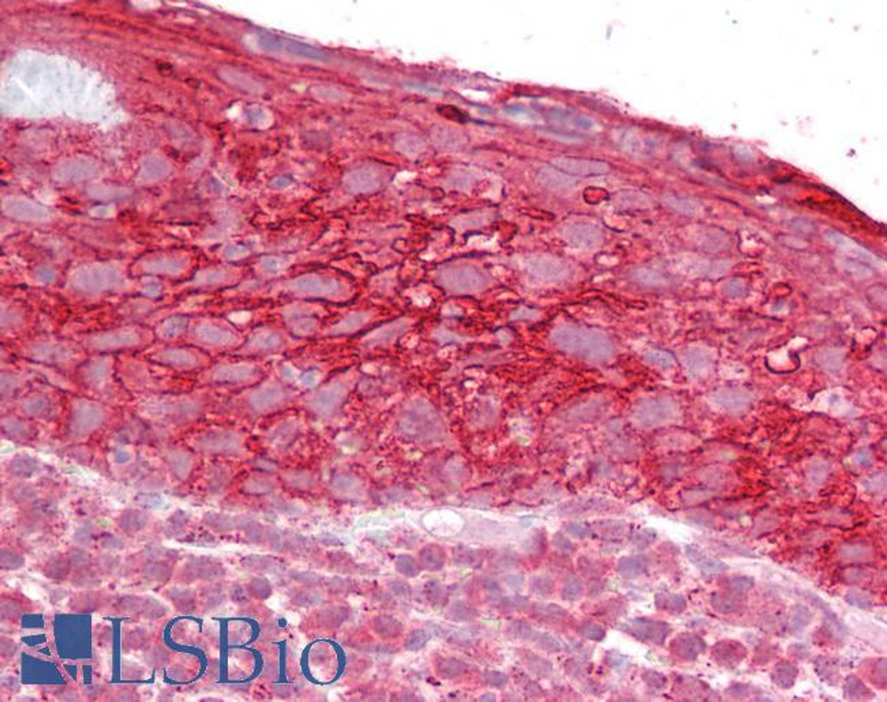 46-967 (0.3ug/ml) staining of Jurkat lysate (35ug protein in RIPA buffer) . Primary incubation was 1 hour. Detected by chemiluminescence.