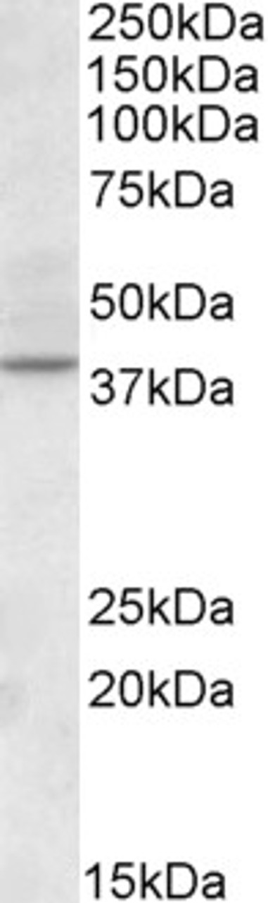 46-984 Immunofluorescence analysis of paraformaldehyde fixed HeLa cells, permeabilized with 0.15% Triton. Primary incubation 1hr (10ug/ml) followed by Alexa Fluor 488 secondary antibody (2ug/ml) , showing cytoplasmic/membrane staining. Actin filaments wer