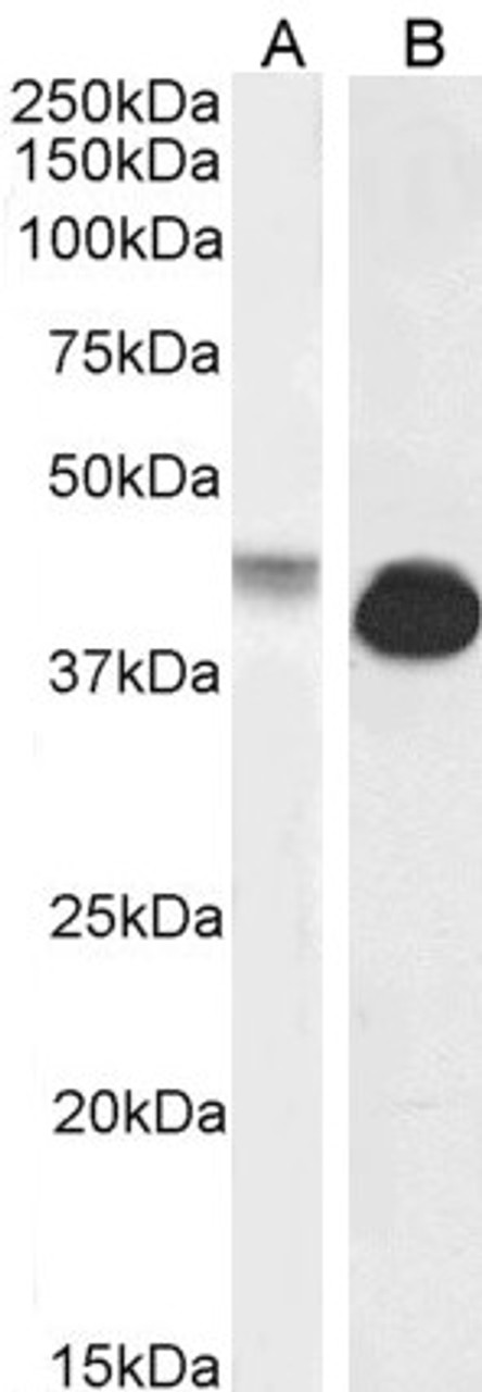 46-994 (0.3ug/ml) staining of HeLa cell lysate (35ug protein in RIPA buffer) . Detected by chemiluminescence.