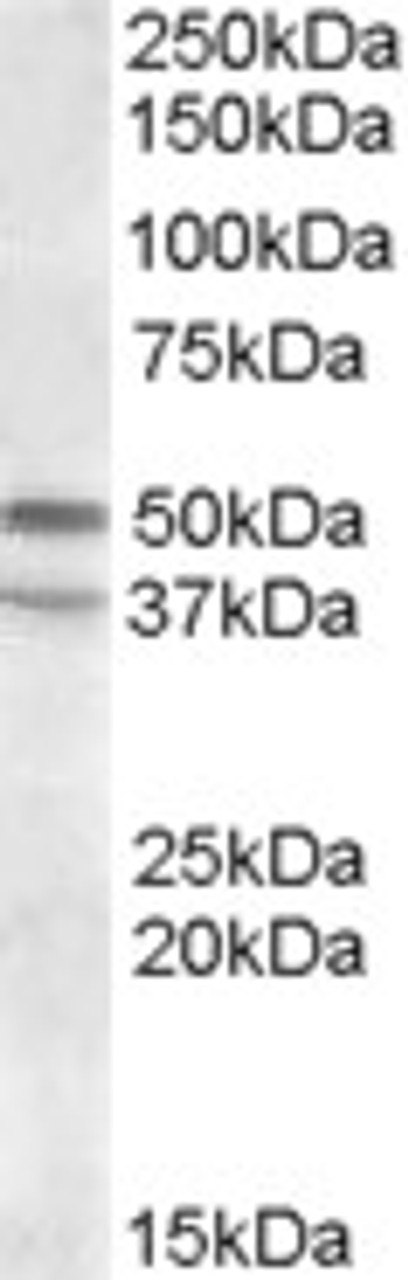 46-997 (3.75ug/ml) staining of paraffin embedded Human Thyroid. Steamed antigen retrieval with citrate buffer pH 6, AP-staining.