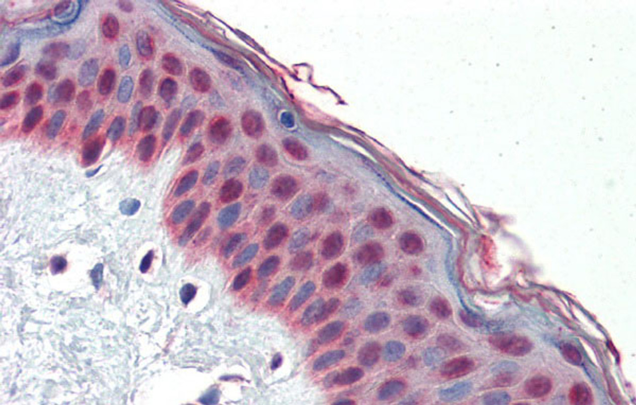 Antibody used in IHC on Human Skin at 5.0 ug/ml.