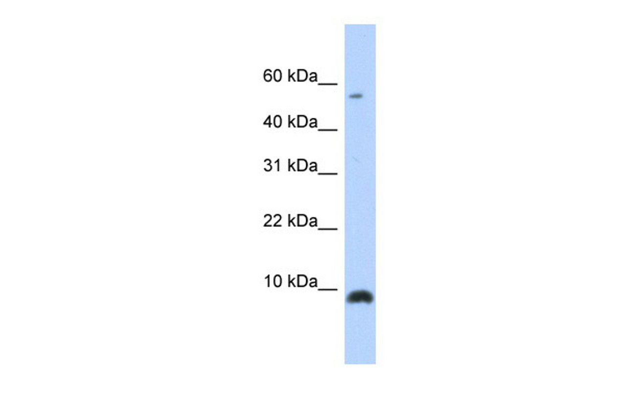 Antibody used in WB on Transfected 293T at 0.2-1 ug/ml.