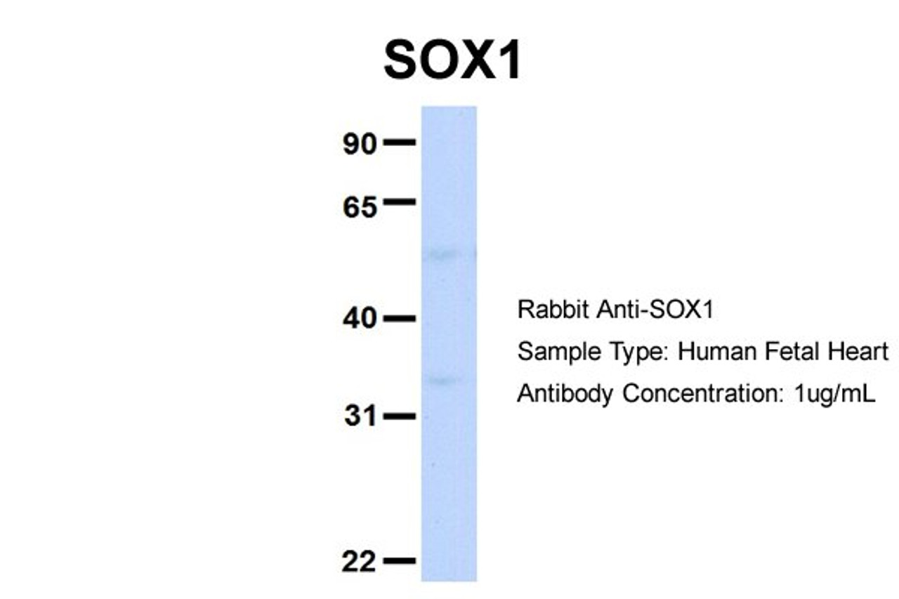 Antibody used in WB on Hum. Fetal Heart at 1 ug/ml.