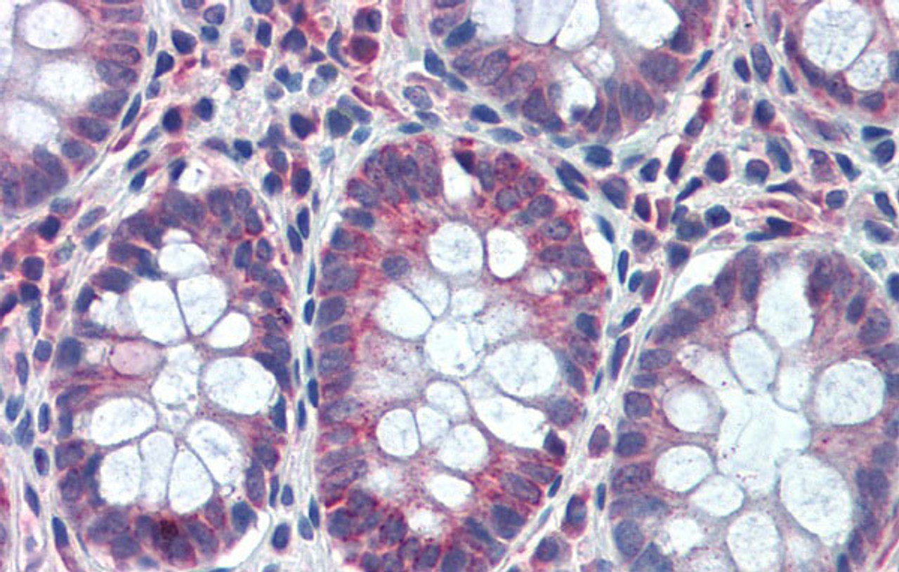 Antibody used in IHC on Human Colon at 5 ug/ml.