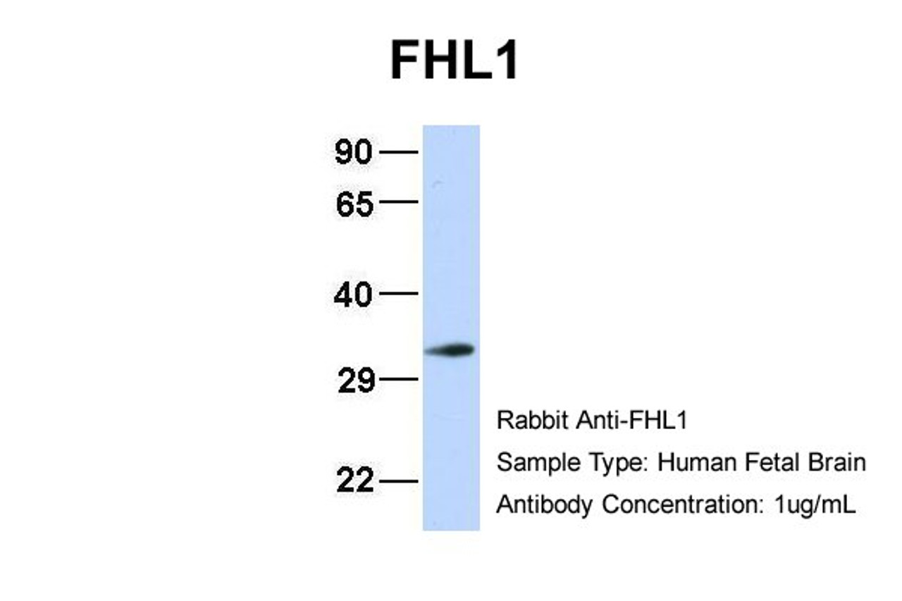 Antibody used in WB on Hum. Fetal Brain at 1 ug/ml.