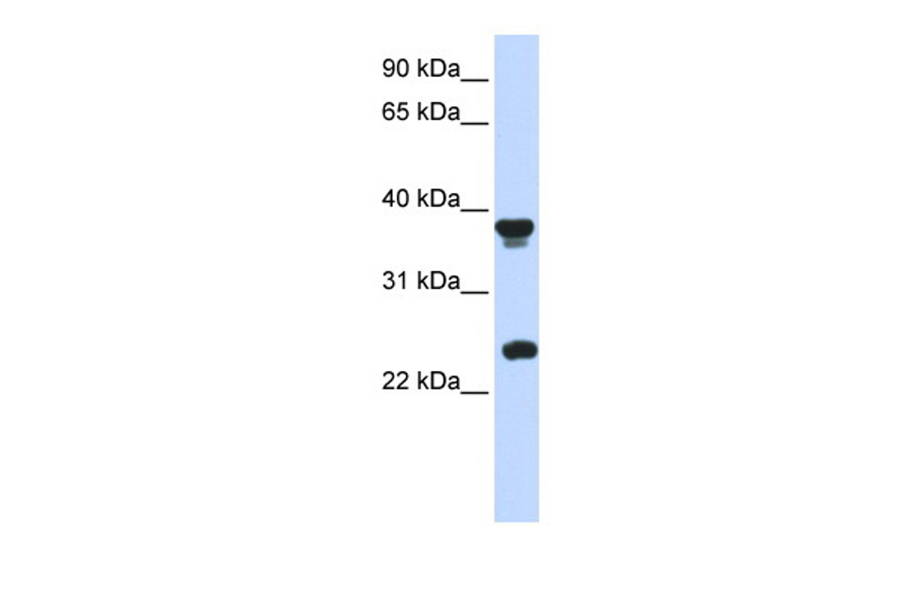 Antibody used in WB on Human Placenta at 0.2-1 ug/ml.