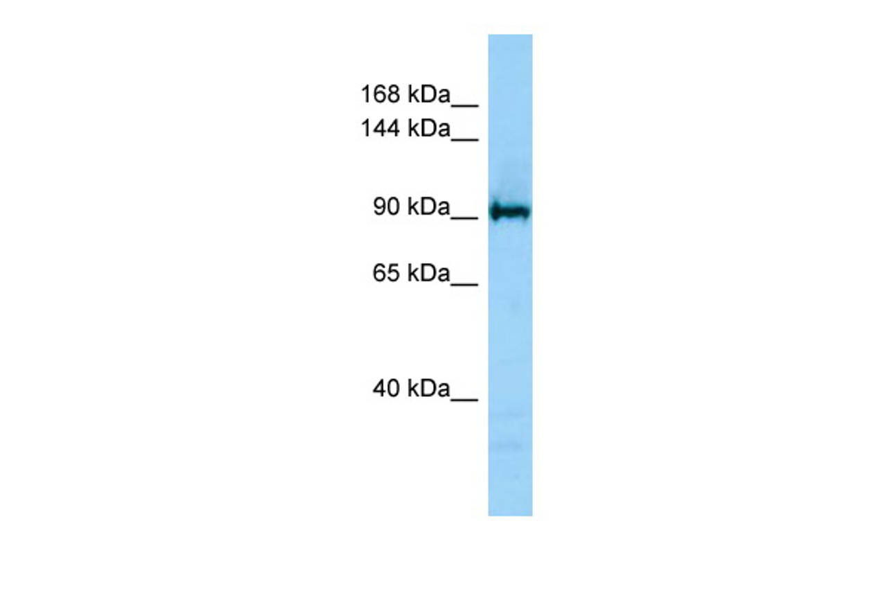 Antibody used in WB on Human Jurkat 1 ug/ml.