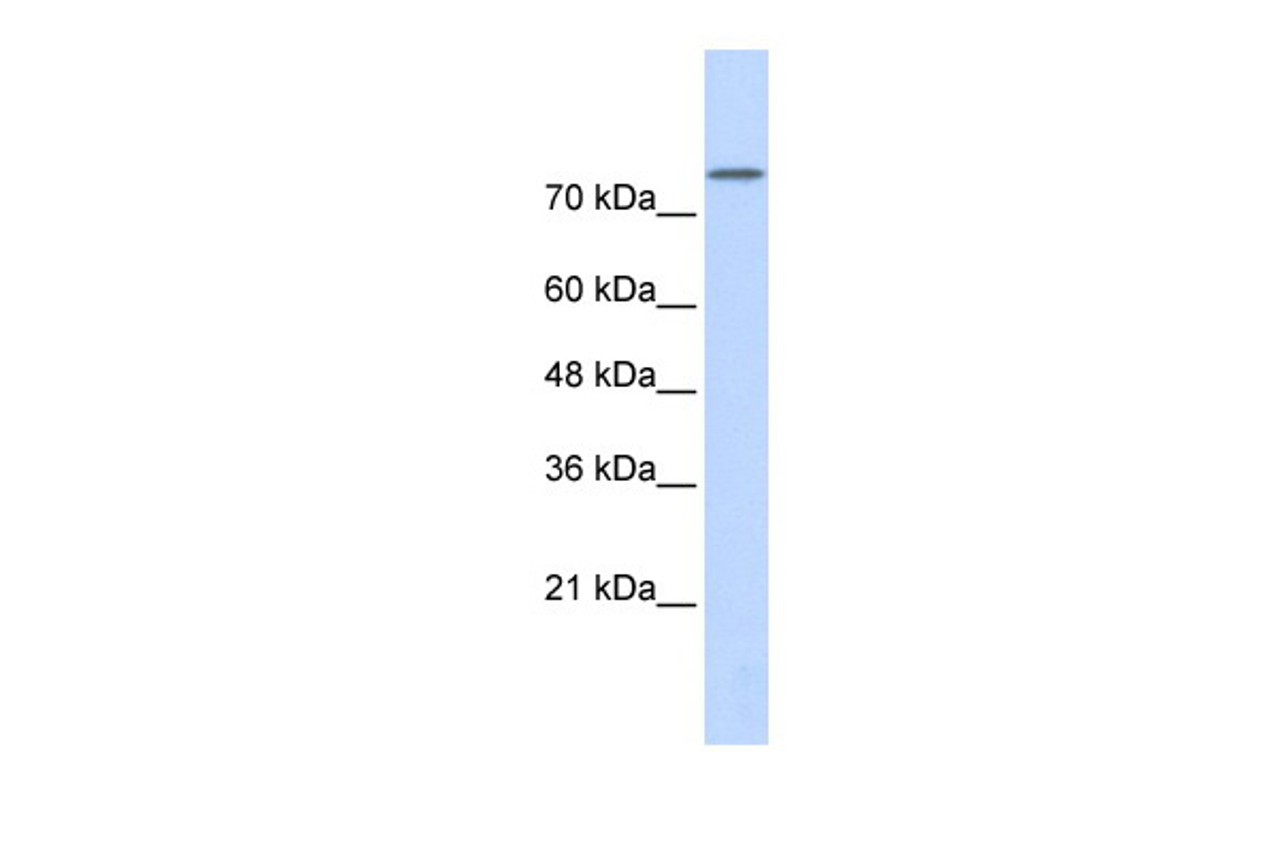 Antibody used in WB on Transfected 293T at 0.2-1 ug/ml.