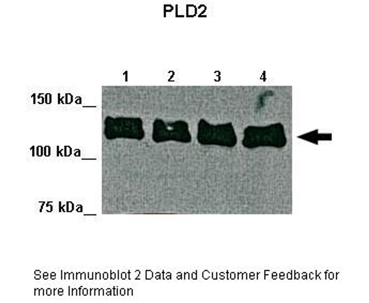 Antibody used in WB on Mouse liver at: 1:1000 (Lane 1 - 4: 22ug mouse liver cell lysate) .