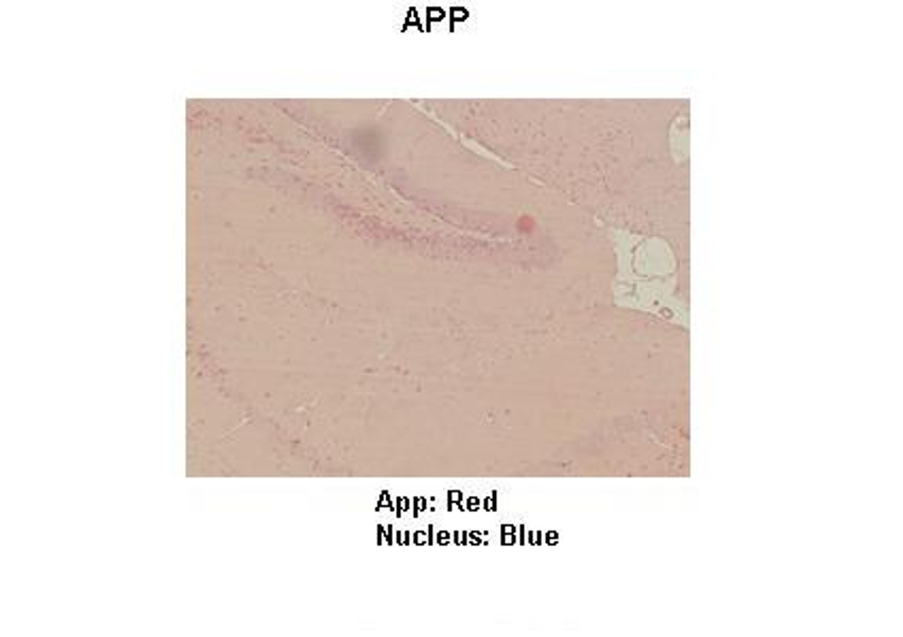 Antibody used in IHC on Mouse hippo campus at 1:100.