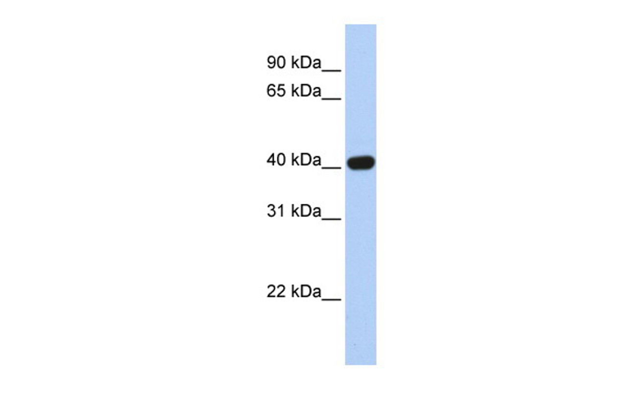 Antibody used in WB on Human Brain at 0.2-1 ug/ml.