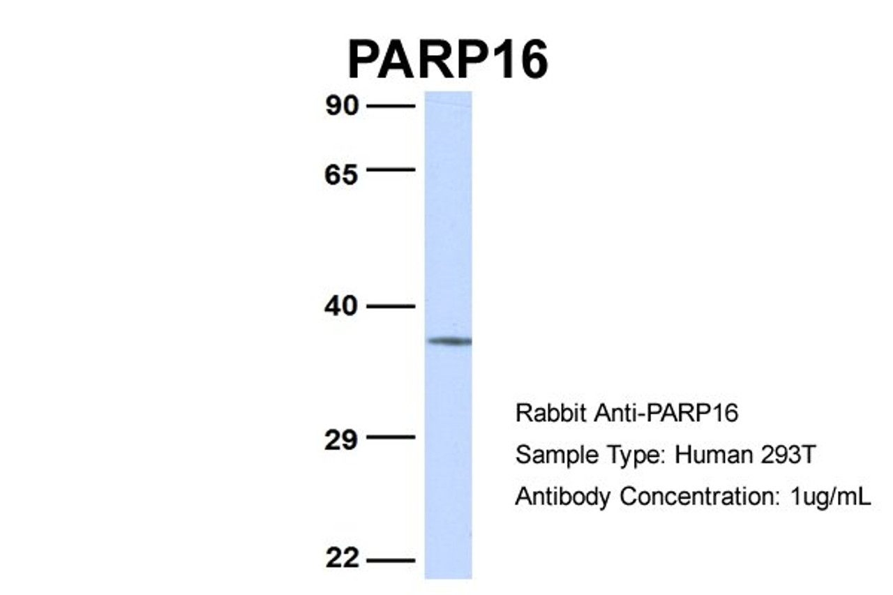 Antibody used in WB on Human 293T at 1 ug/ml.