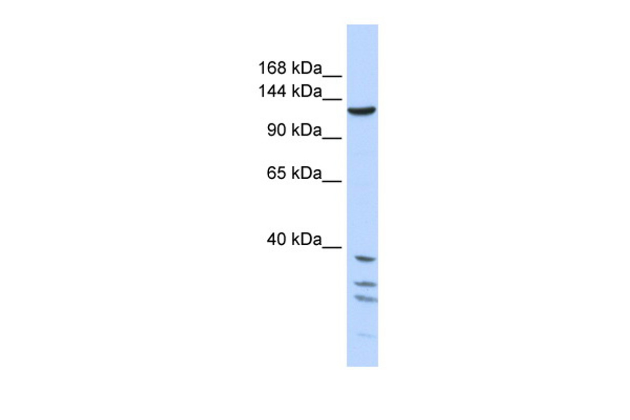 Antibody used in WB on Human 721_B cells at 1 ug/ml.