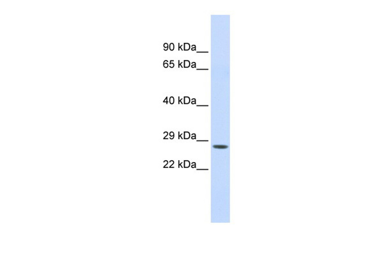 Antibody used in WB on Human Liver at 0.2-1 ug/ml.