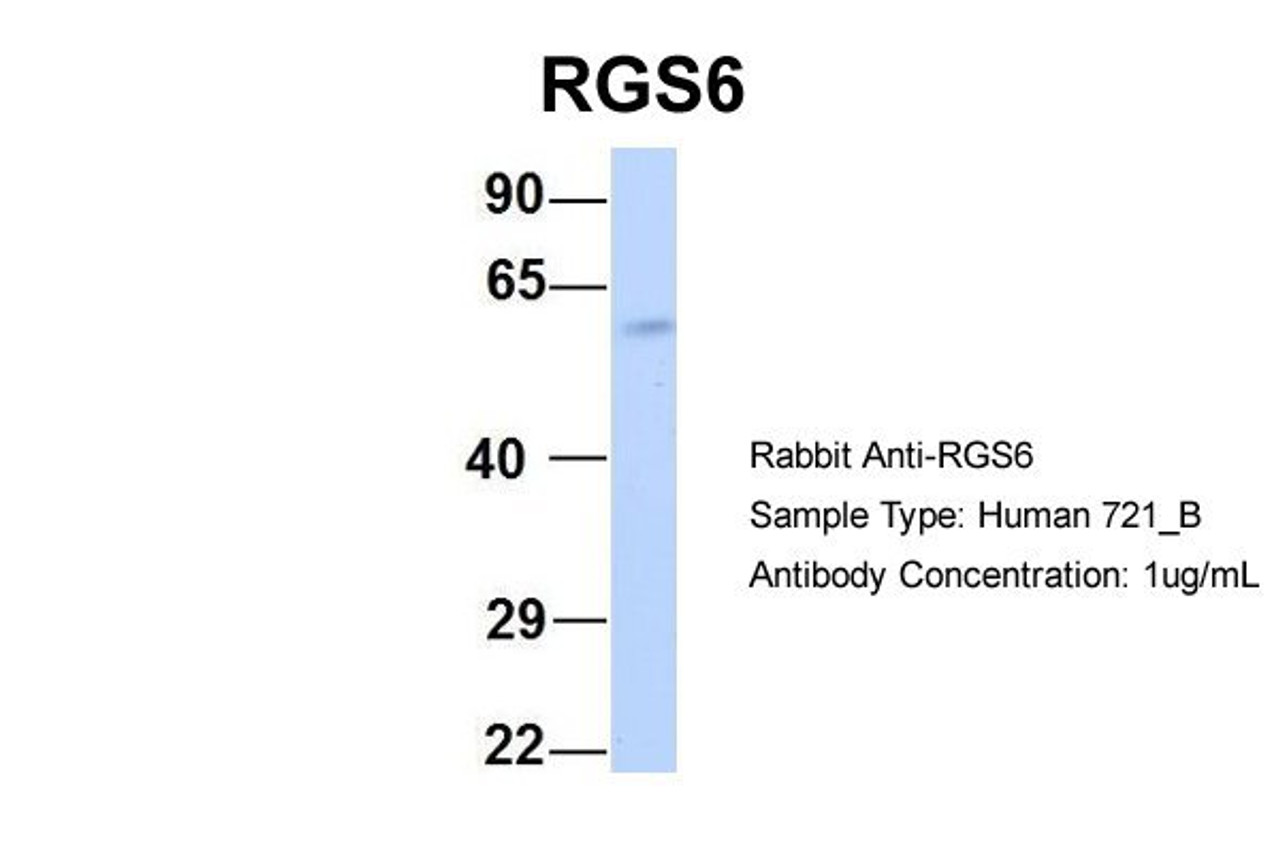 Antibody used in WB on Human 721_B cells at 1 ug/ml.