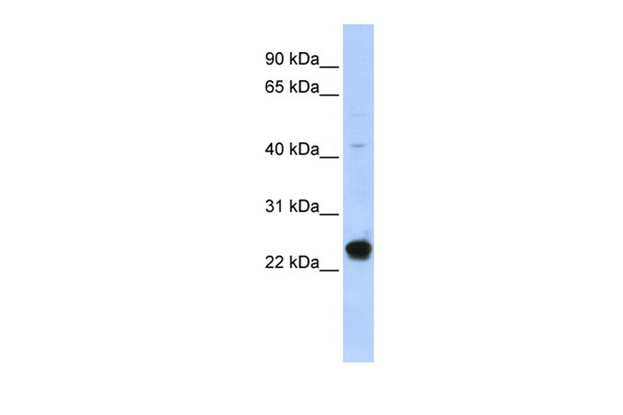 Antibody used in WB on Human HepG2 at 0.2-1 ug/ml.