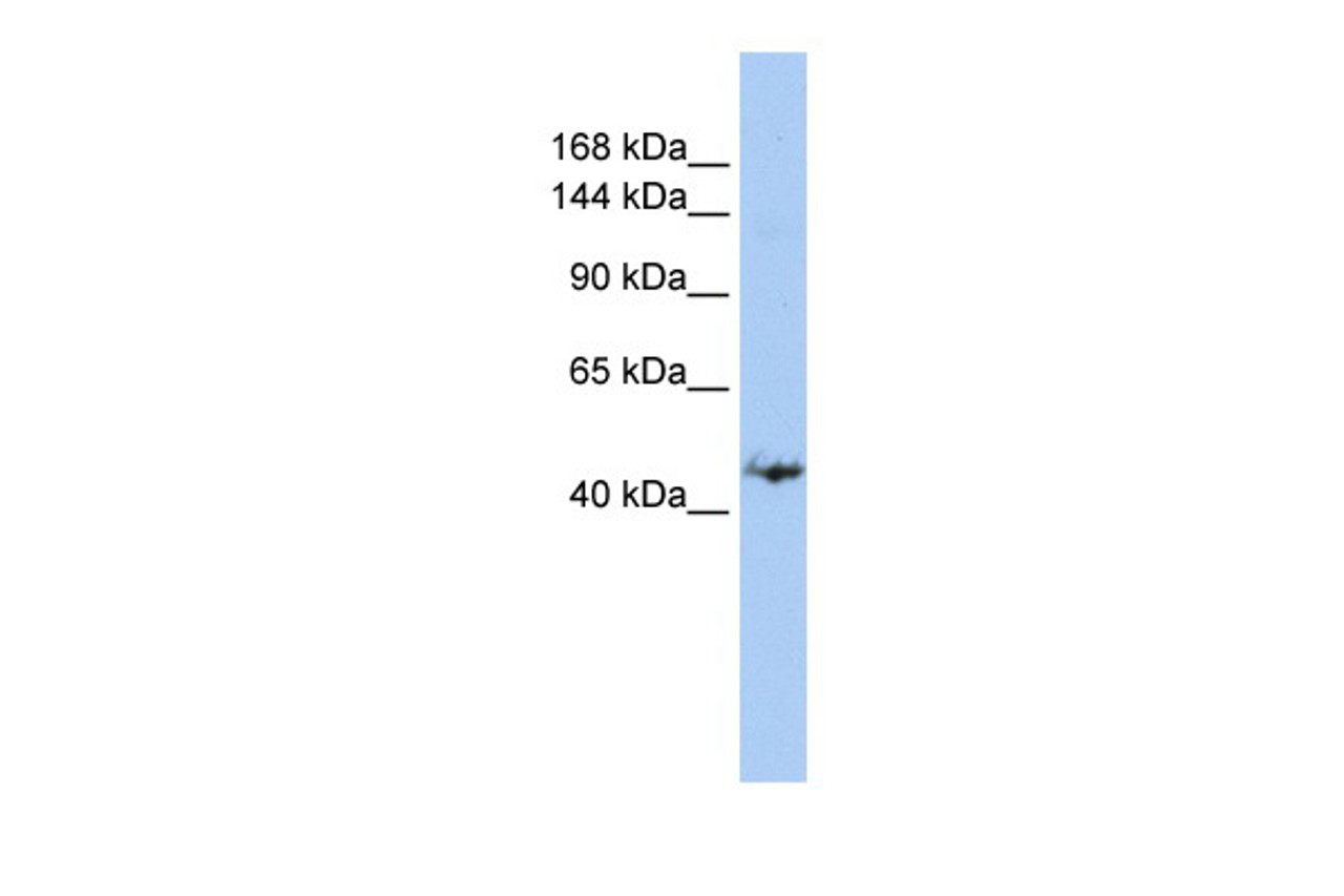 Antibody used in WB on Human MCF-7 at 0.2-1 ug/ml.