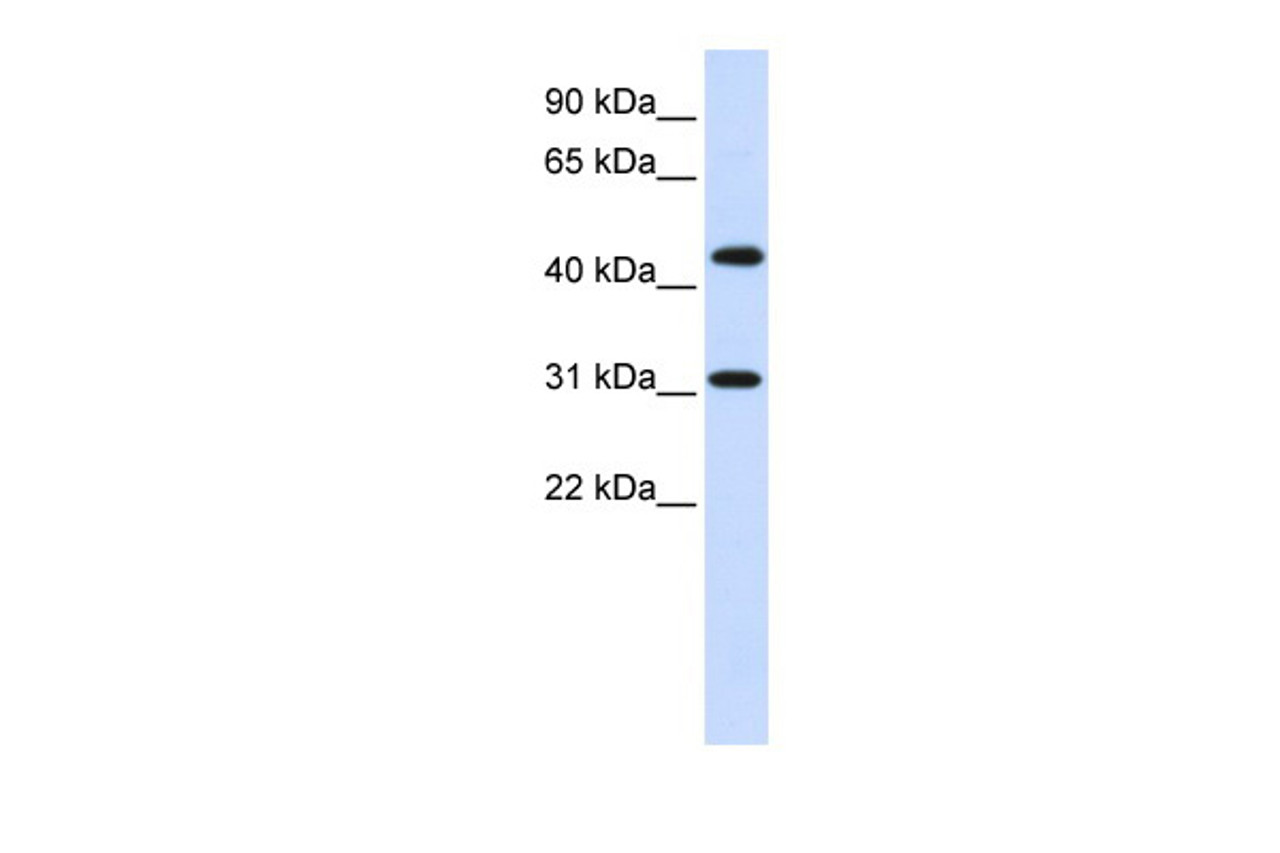 Antibody used in WB on Human Brain at 0.2-1 ug/ml.