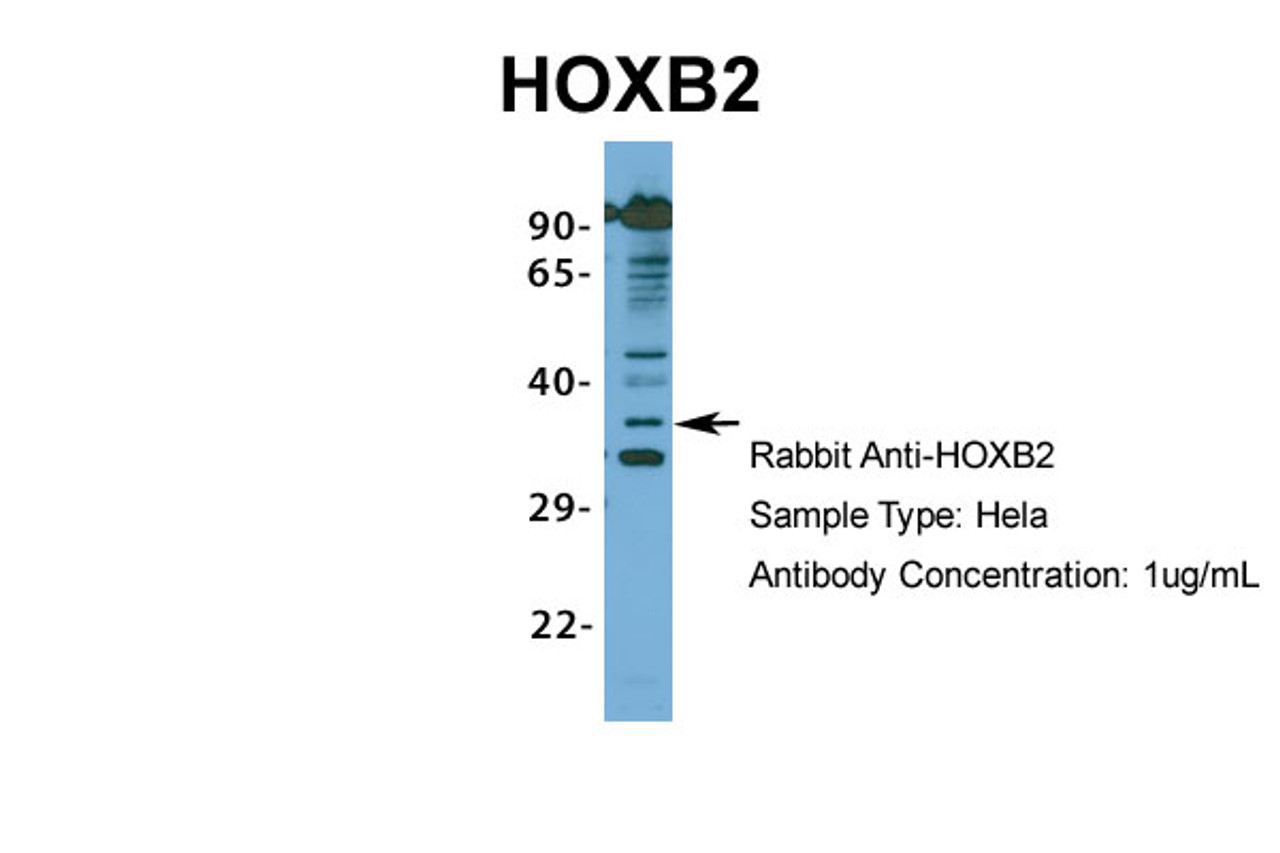 Antibody used in WB on Human Hela at 1 ug/ml.