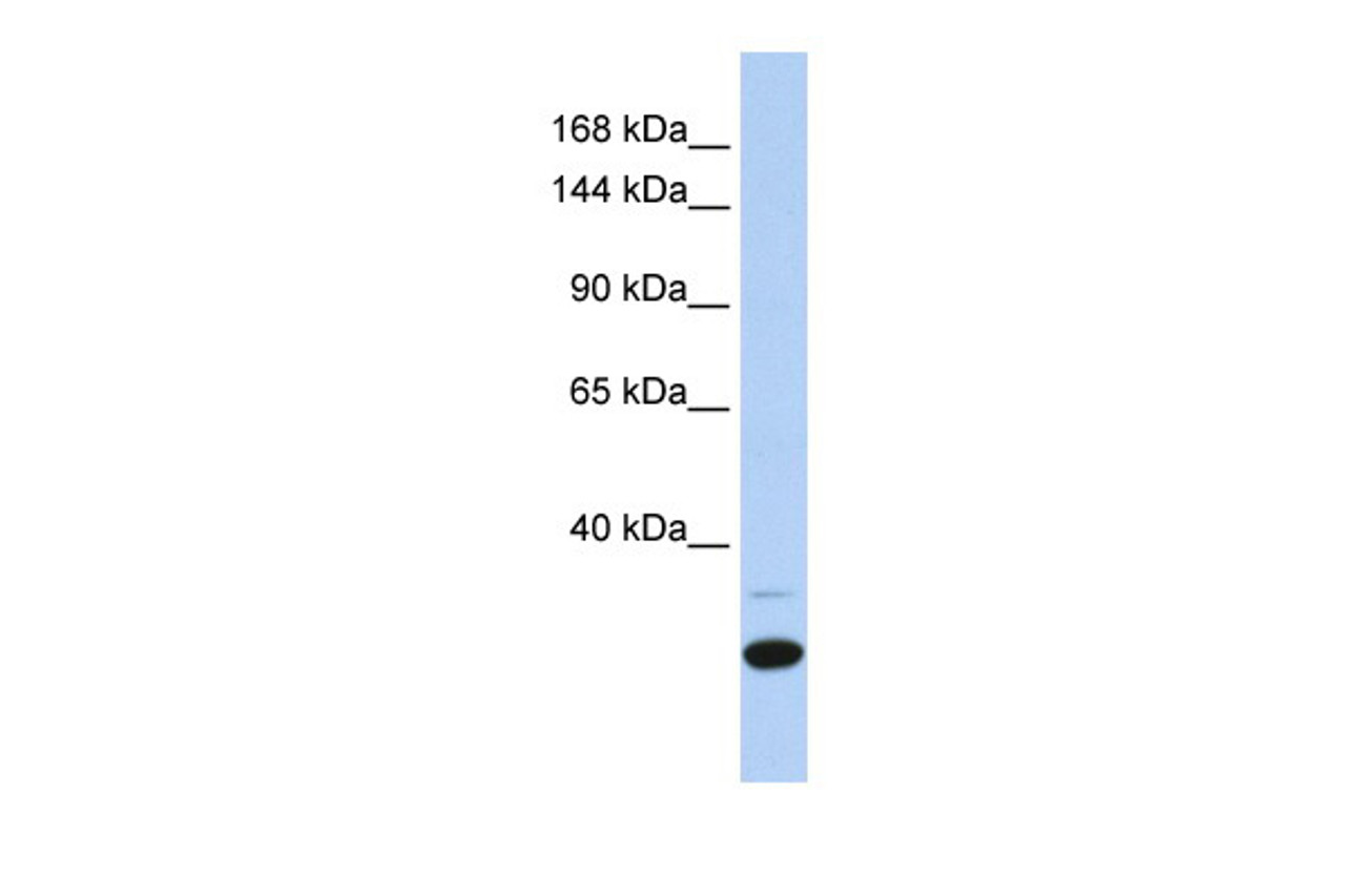 Antibody used in WB on Human Heart at 0.2-1 ug/ml.