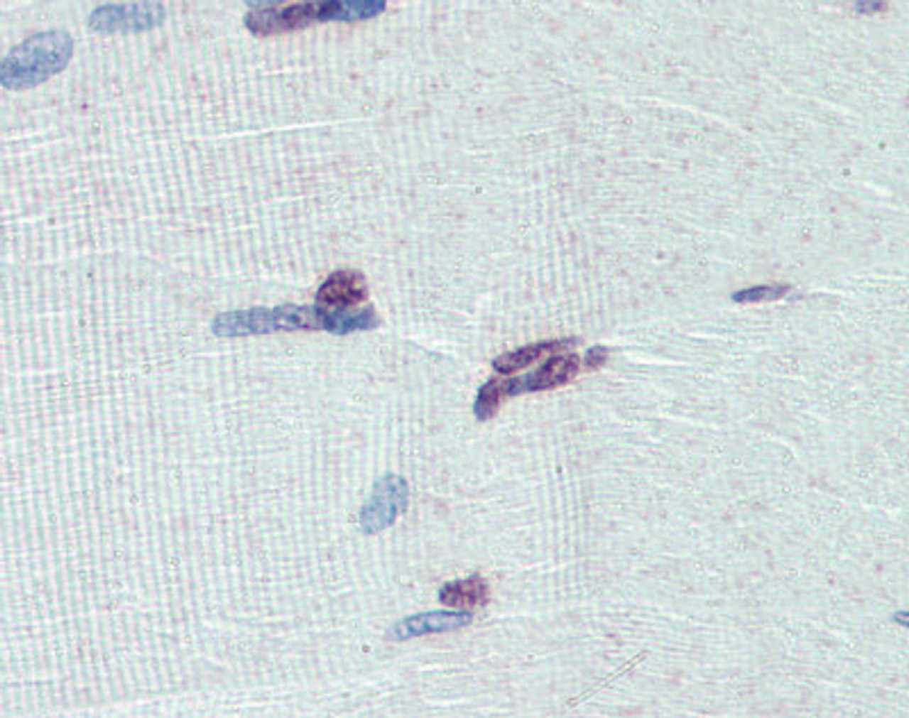 Antibody used in IHC on Human Testis at 5 ug/ml.