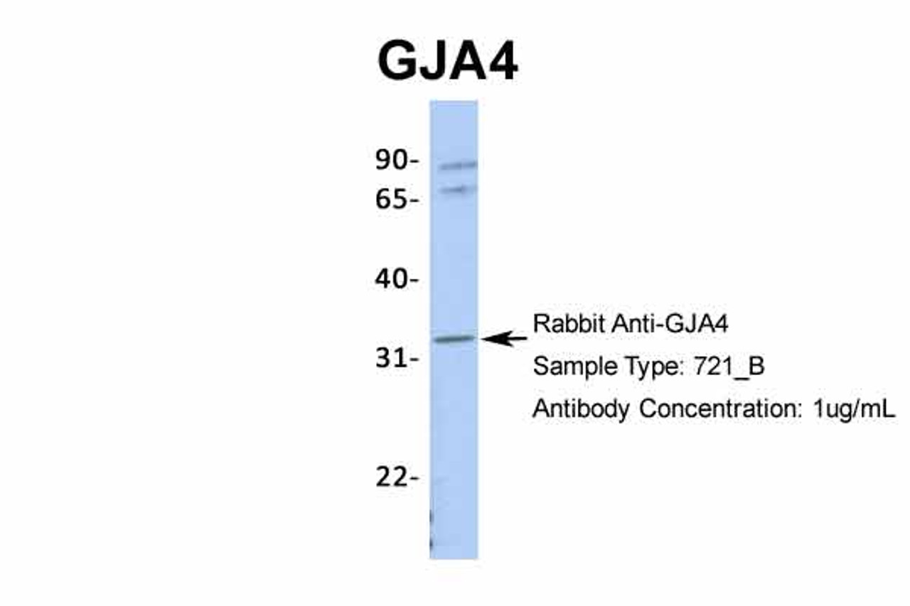 Antibody used in WB on Human 721_B at 1 ug/ml.