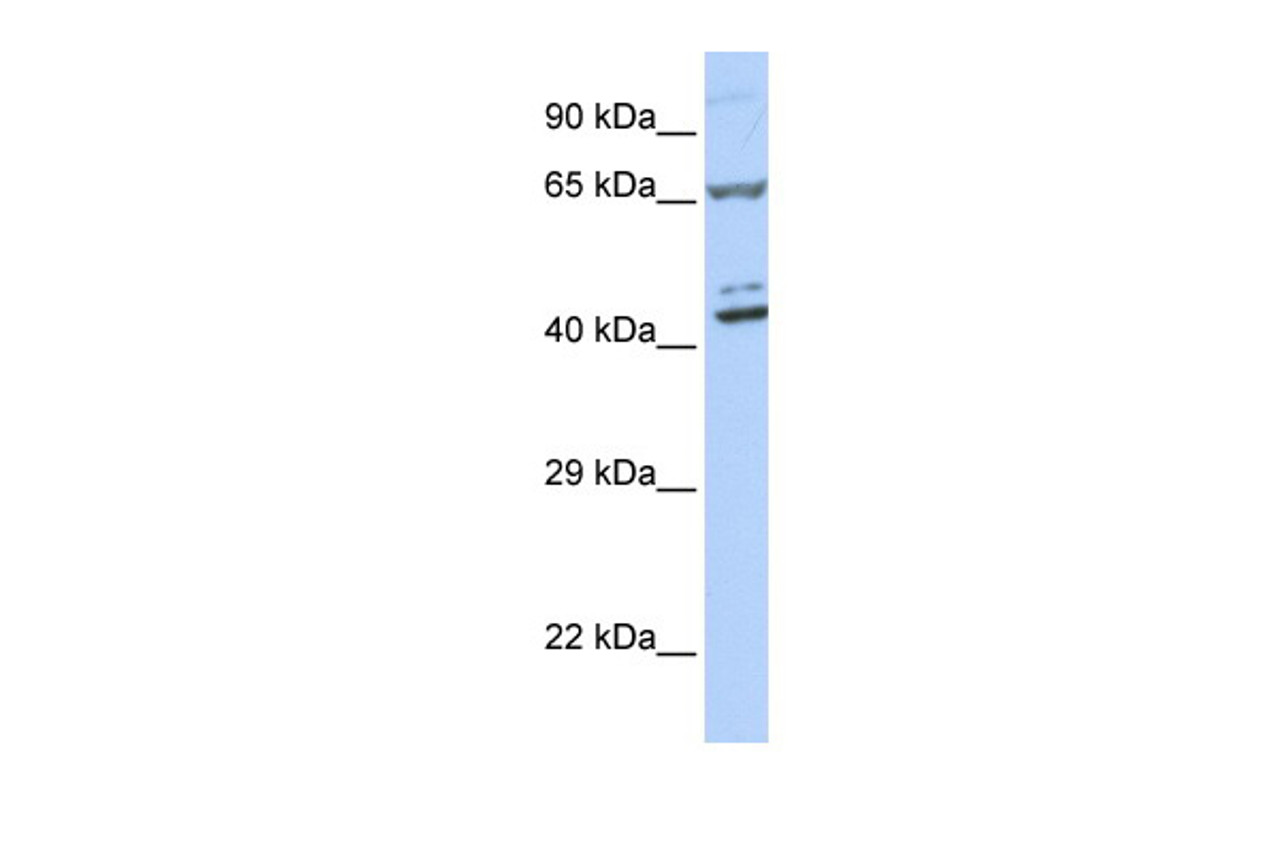 Antibody used in WB on Human 721_B at 0.2-1 ug/ml.