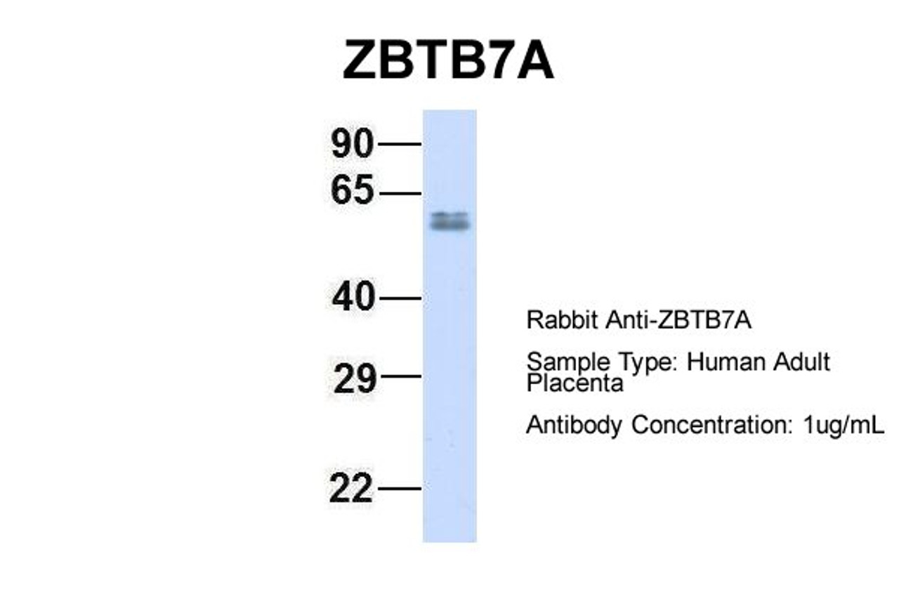 Antibody used in WB on Hum. Adult Placenta at 1 ug/ml.