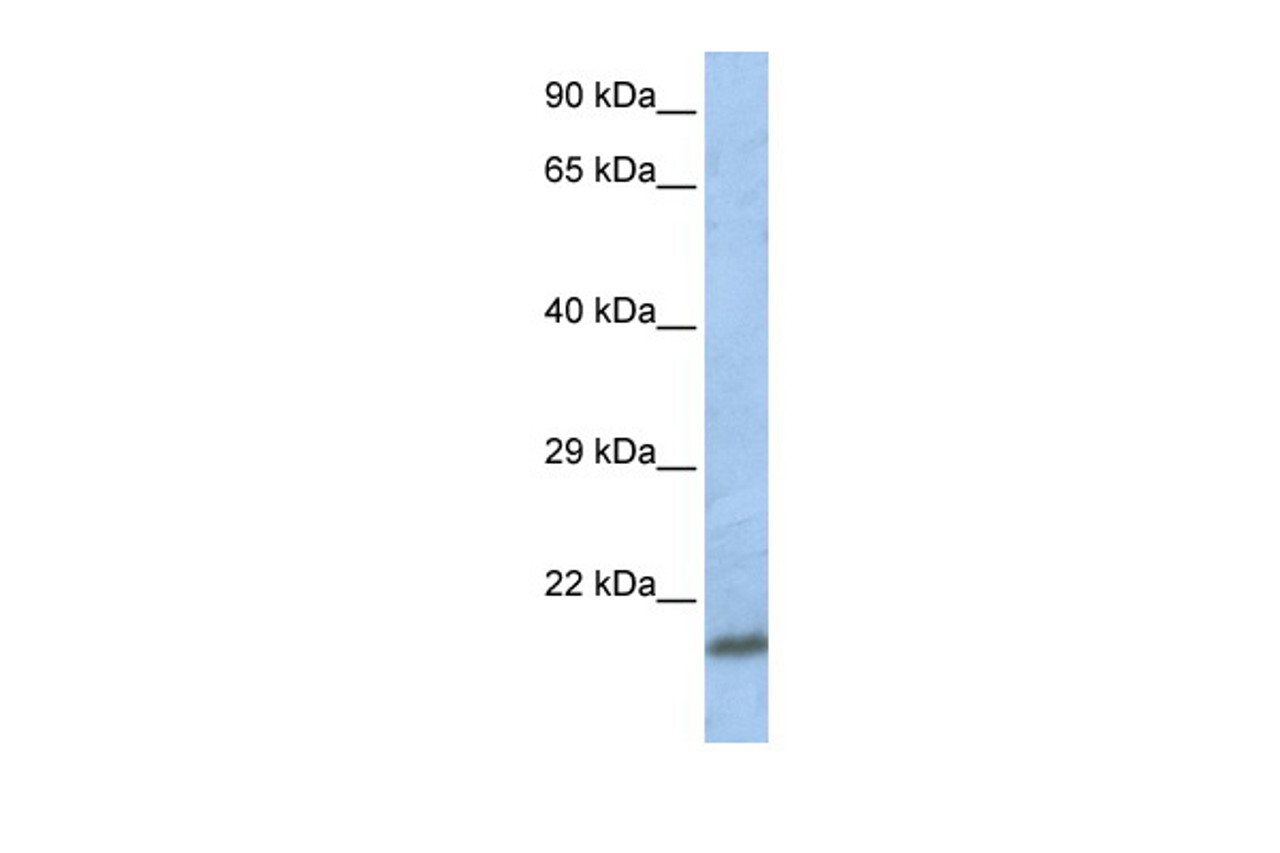 Antibody used in WB on Human Jurkat 0.2-1 ug/ml.