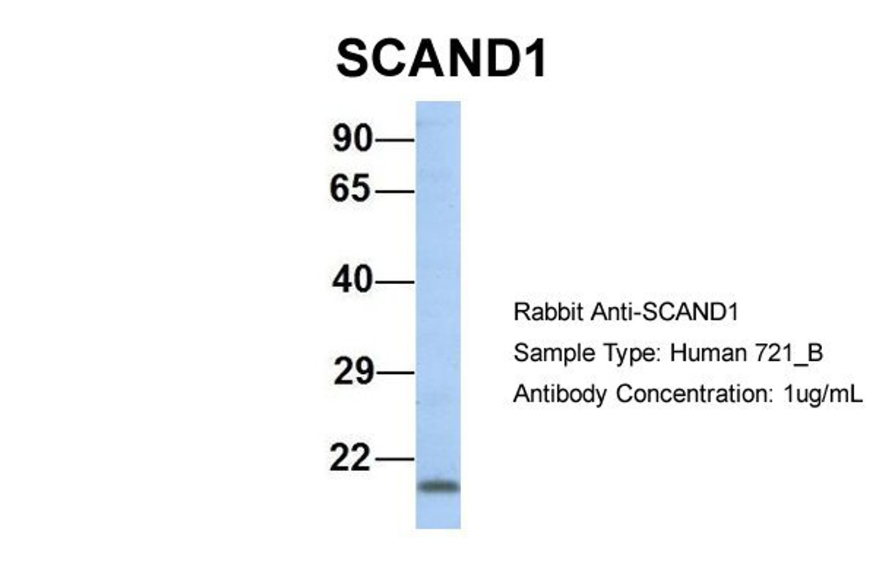 Antibody used in WB on Human 721_B at 1 ug/ml.