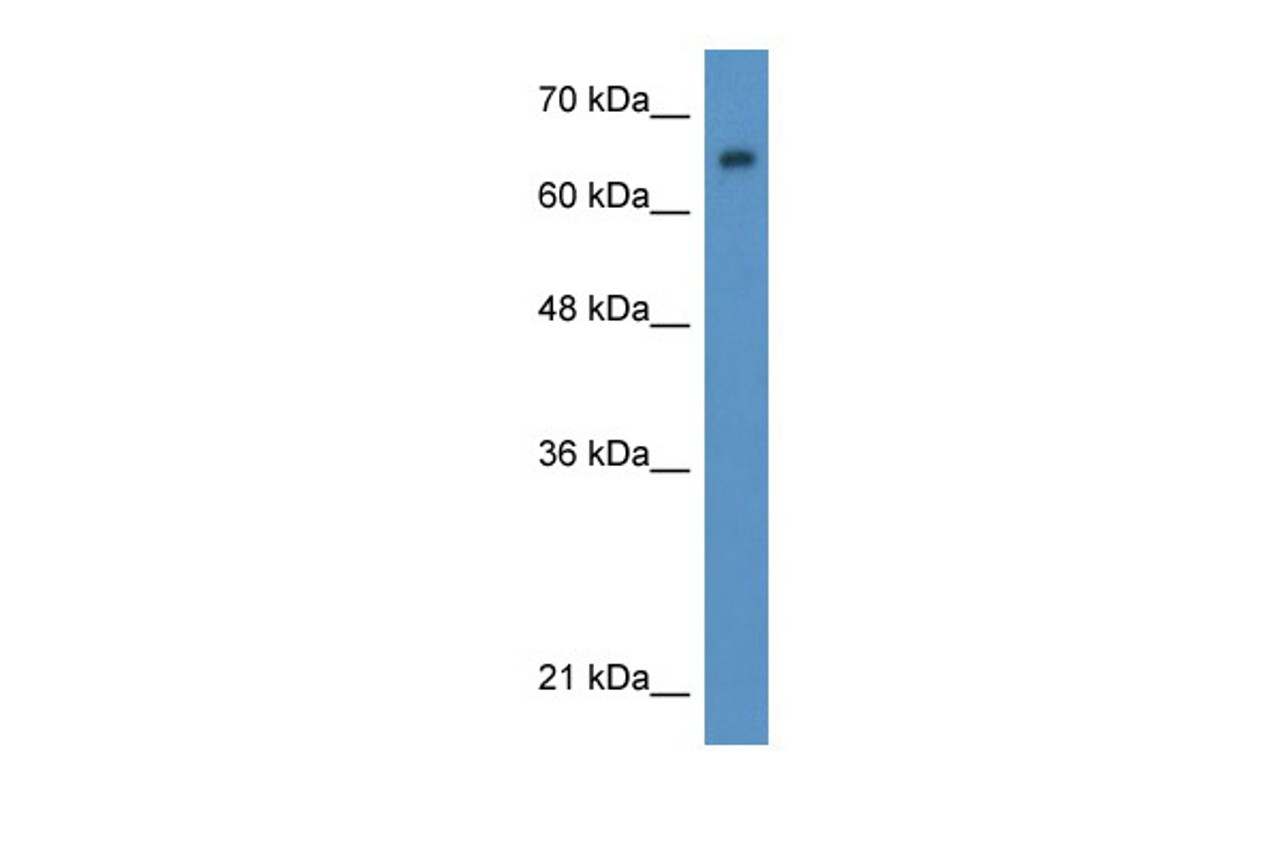 Antibody used in WB on Human HeLa at 0.2-1 ug/ml.