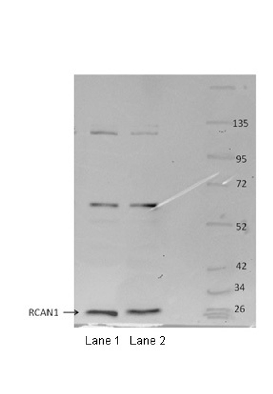 Antibody used in WB on mouse osteoclasts at 1:1000.