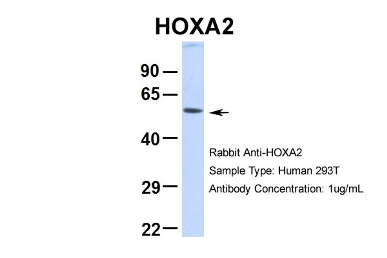 Antibody used in WB on Hum. Fetal Muscle.