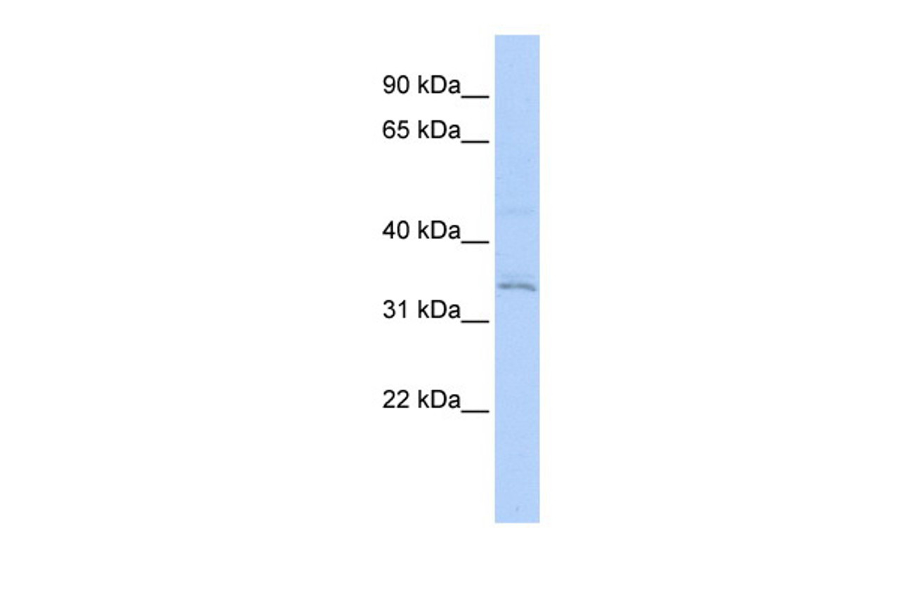 Antibody used in WB on Transfected 293T at 0.2-1 ug/ml.