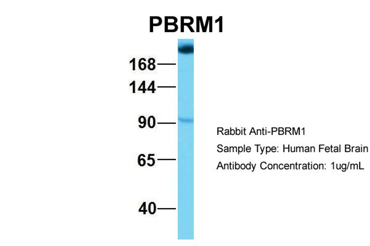 Antibody used in WB on Hum. Fetal Brain at 1 ug/ml.