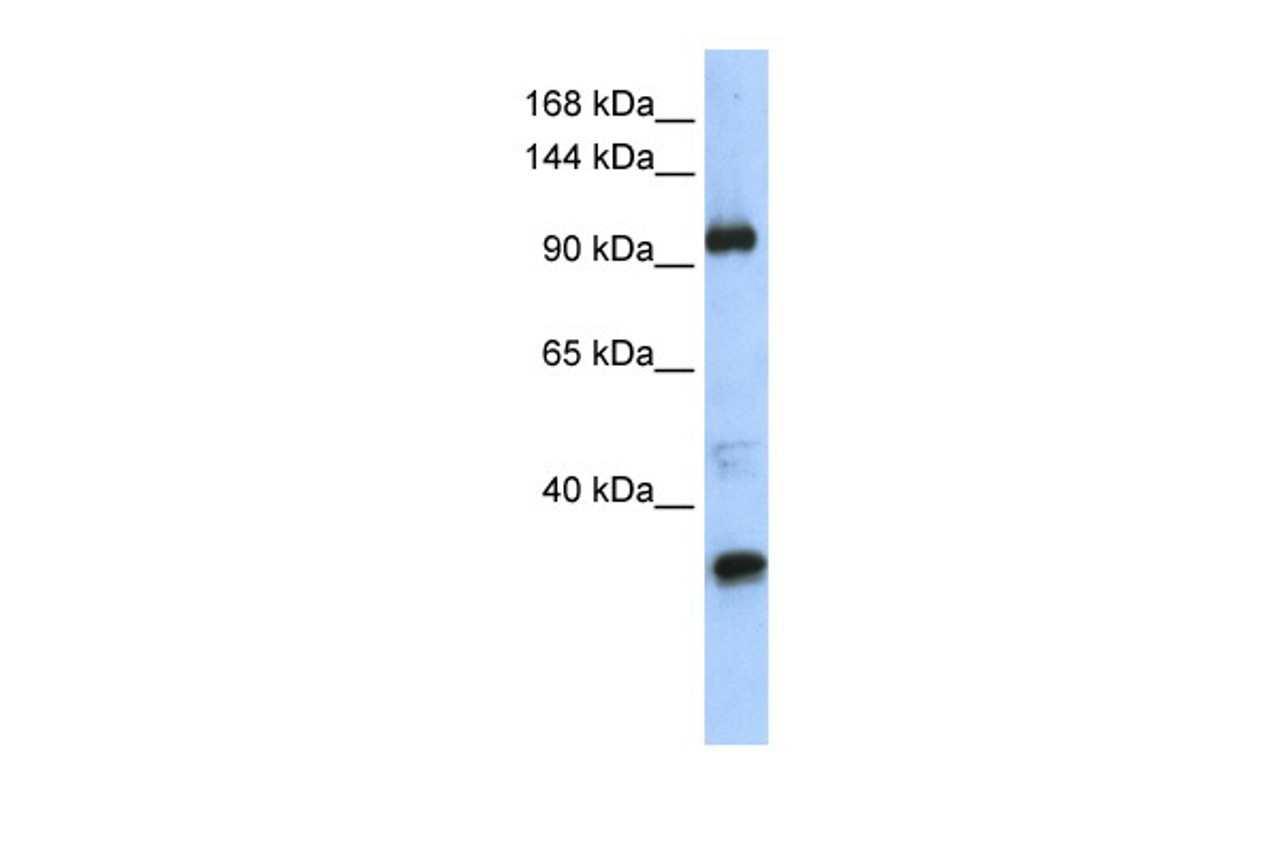 Antibody used in WB on Transfected 293T at 0.2-1 ug/ml.