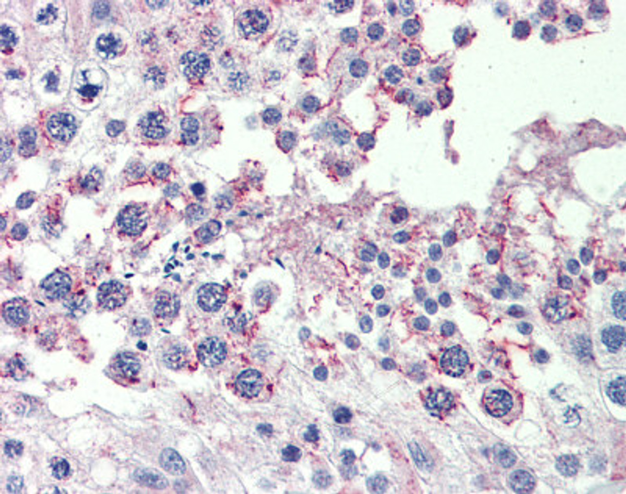 Antibody used in IHC on Human testis at 10 ug/ml.