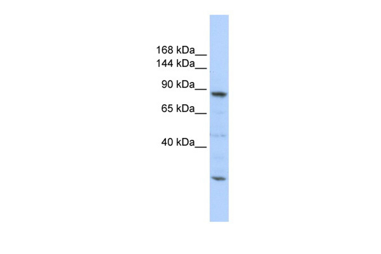 Antibody used in WB on Human 721_B at 0.2-1 ug/ml.